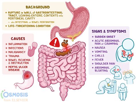 Peptic ulcer disease (PUD) is characterized by discontinuation in the inner lining of the gastrointestinal (GI) tract because of gastric acid secretion or pepsin. . Gastrointestinal perforation meaning